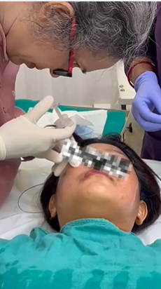 Dermal Fillers Workshop