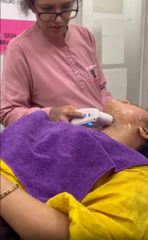 Wrinkle reduction procedure